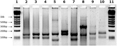 Large Interruptions of GAA Repeat Expansion Mutations in Friedreich Ataxia Are Very Rare